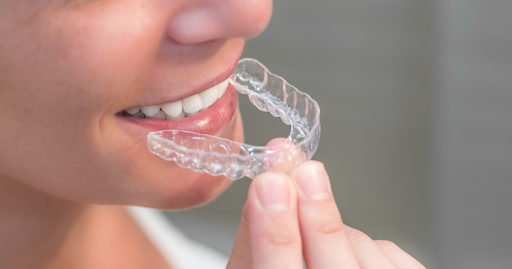 5 Celebrity Secrets to Perfect Teeth The Power of Braces and Aligners